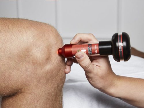 Energy-Laser  L500 Pro lágylézer