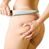 Alakformáló kezelés