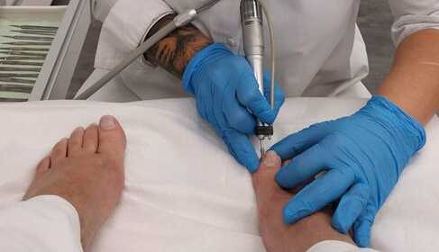 Pedikűrös, podiáter és speciális lábápoló… mivel fordulj hozzájuk?
