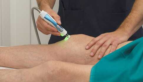 Artritisz (ízületi gyulladás) és lágylézer