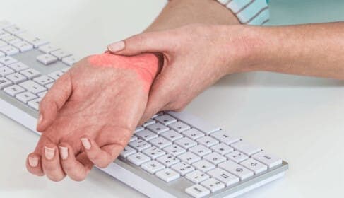 Kéztőalagút szindróma – amit tudnod kell a megelőzésről és kezelésről