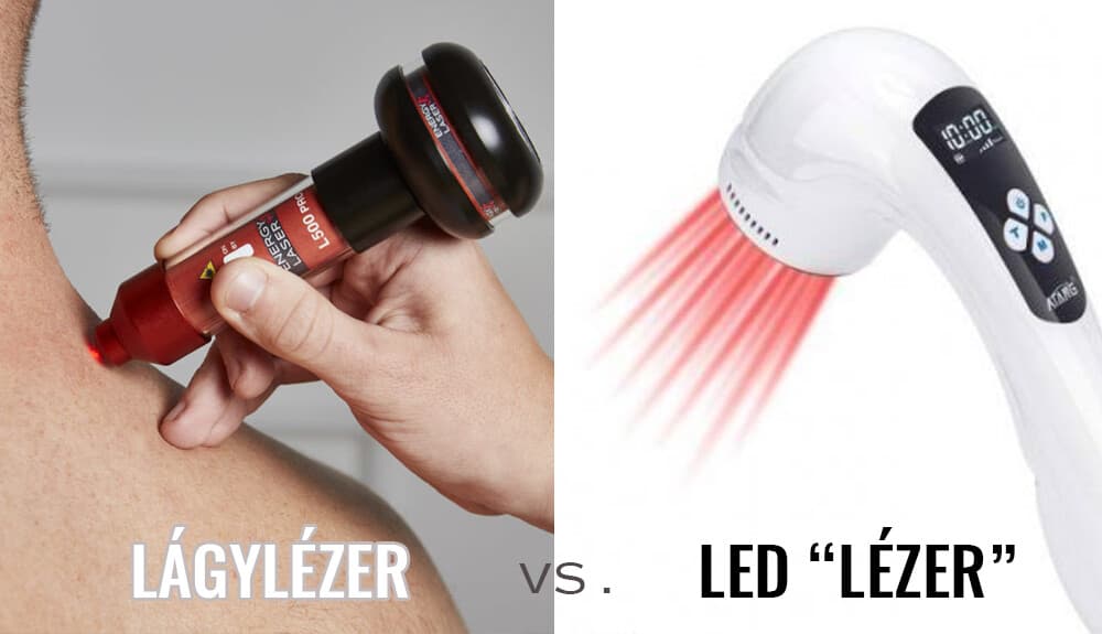 61ec16441d2fa-61ec16441d300lagylezer-vs-led-lezer.jpg.jpg