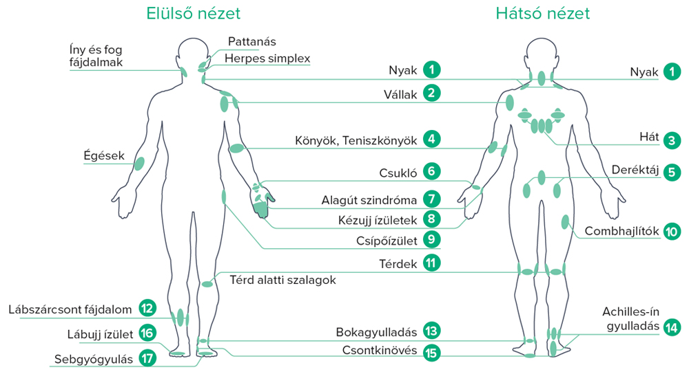 B-Cure-laser-terapia-pontok.jpg