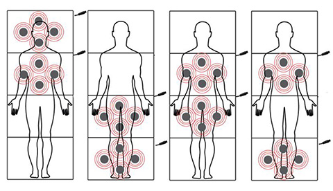 Total-Body-200-foam-magnetoterápiás-matrac.png
